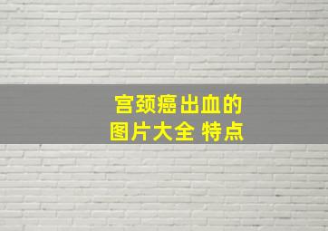 宫颈癌出血的图片大全 特点